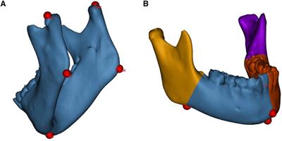 Quantitative structural analysis of hemifacial microsomia mandibles in different age groups